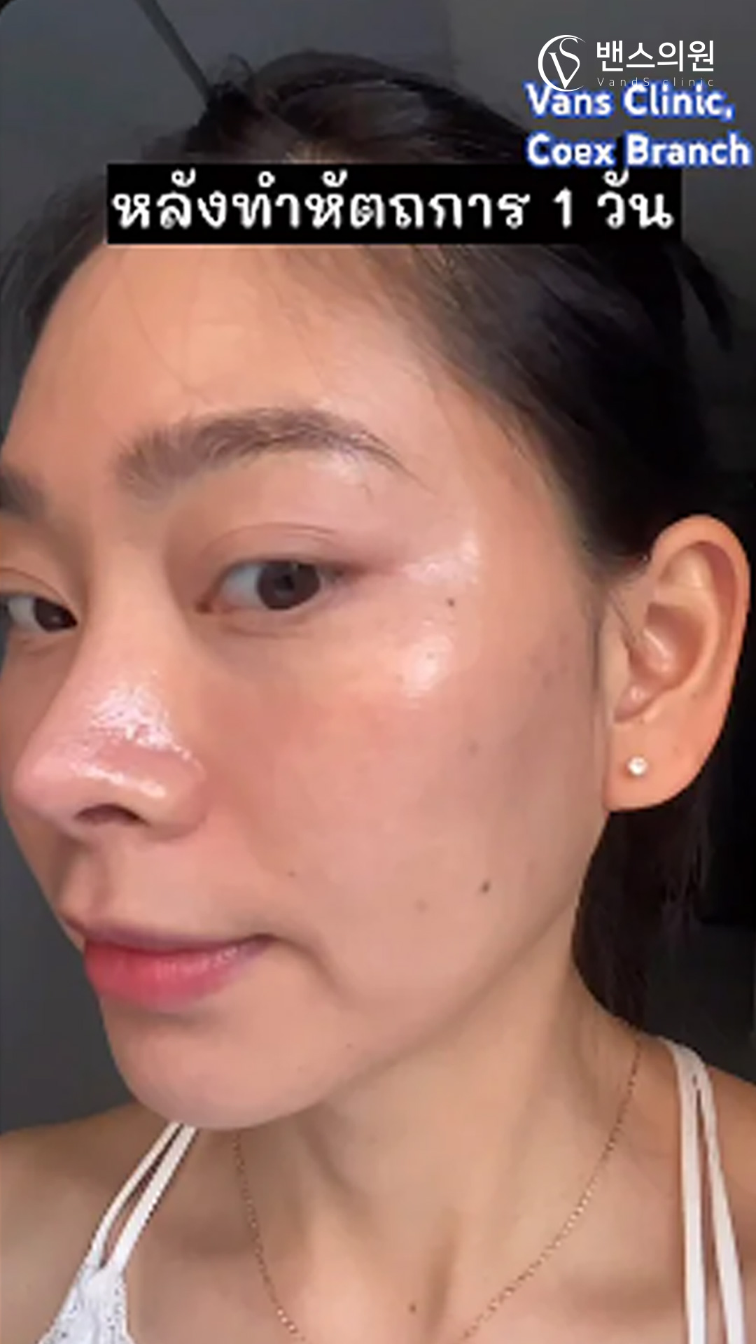 VandS Clinic Video